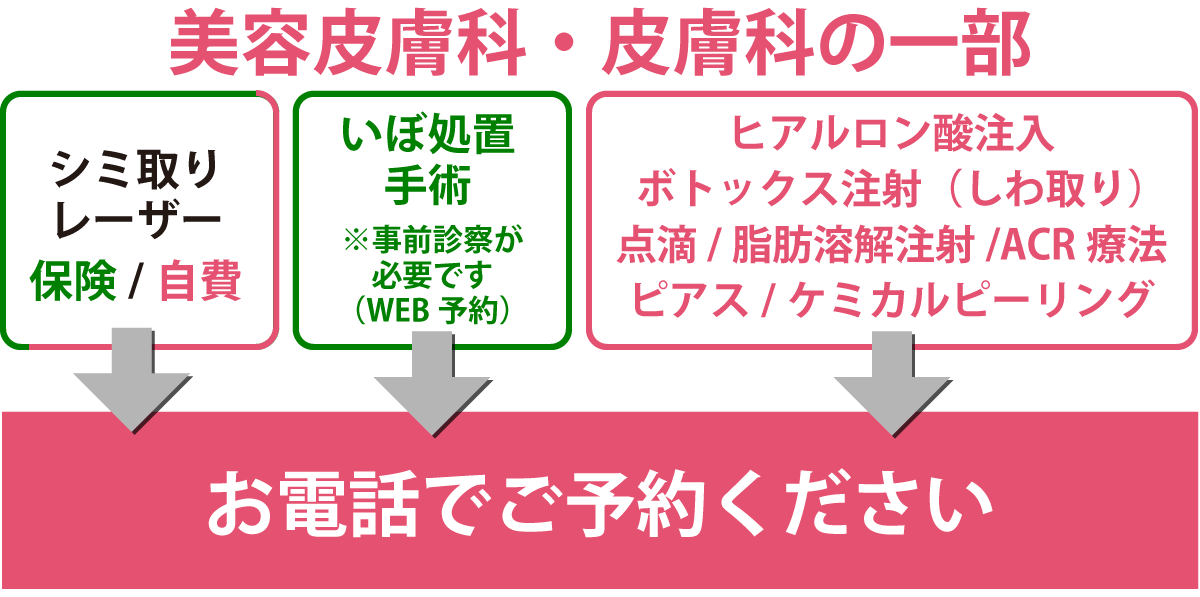 予約方法
